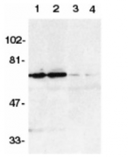 SP1298 - TNFRSF21 / Death receptor 6 (DR6)