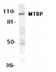 SP1310 - MTBP