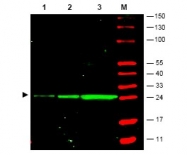 R1461P - GFP