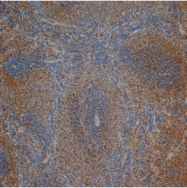 SM253P - CD3 delta chain