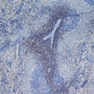 SM255PS - CD4