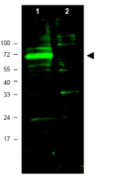 R1575P - HIF3A / HIF3 alpha