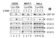 R1493 - ZNF148