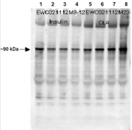R1528P - Glycogen Synthase