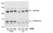 R1467 - AKT2 / PKB beta