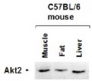 R1467 - AKT2 / PKB beta