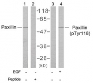 AP02638PU-S - Paxillin / PXN