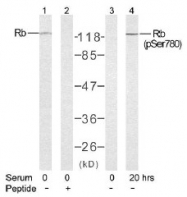AP02641PU-S - Retinoblastoma-associated protein / RB1