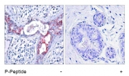 AP02304PU-S - GSK3 beta