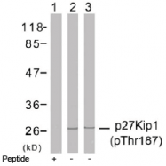 AP02472PU-S - CDKN1B / KIP1