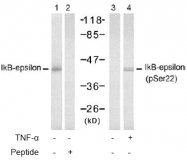 AP02473PU-S - NFKBIE / IKBE