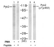 AP02475PU-S - FAK2 / PTK2B