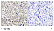 AP02476PU-S - RELA / NF-kB p65