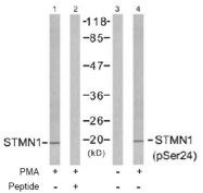 AP02483PU-N - Stathmin / STMN1