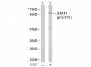 AP02343PU-S - STAT1