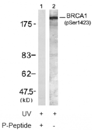 AP02496PU-S - BRCA1 / RNF53