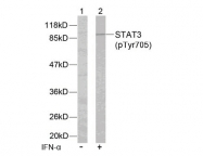AP02344PU-S - STAT3