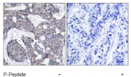 AP02501PU-N - HSPB1 / HSP27