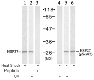 AP02501PU-N - HSPB1 / HSP27