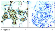 AP02505PU-S - MAP kinase p38 alpha / MAPK14