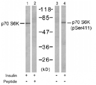 AP02516PU-S - RPS6KB1 / STK14A