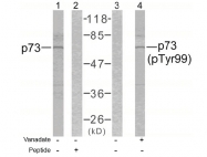 AP02357PU-S - Tumor protein p73 (TP73)