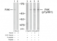 AP02358PU-S - FAK1 / PTK2