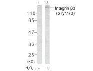 AP02359PU-N - CD61 / ITGB3