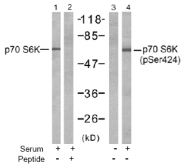 AP02525PU-S - RPS6KB1 / STK14A