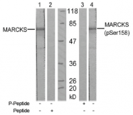 AP02531PU-S - MARCKS