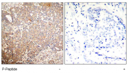 AP02537PU-S - Cytokeratin 18