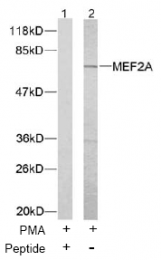AP02581PU-S - MEF2A