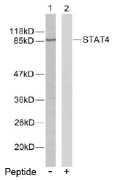 AP02588PU-S - STAT4