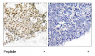 AP02599PU-S - Nibrin