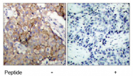 AP02614PU-S - EGFR / ERBB1