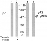 AP02615PU-S - Tumor protein p73 (TP73)