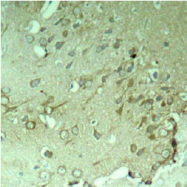 AP02627PU-S - MAPT / TAU
