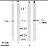 AP02630PU-S - MAPT / TAU