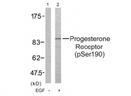 AP02372PU-S - Progesterone receptor