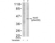 AP02375PU-S - MYOD1