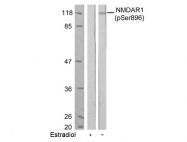 AP02396PU-S - NMDA Receptor 1