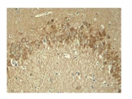 AP02399PU-S - MAPT / TAU
