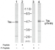AP02399PU-S - MAPT / TAU