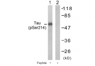 AP02401PU-S - MAPT / TAU