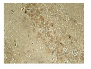 AP02403PU-S - MAPT / TAU