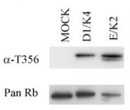 SM1842P - Retinoblastoma-associated protein / RB1