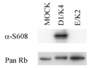 SM1843P - Retinoblastoma-associated protein / RB1
