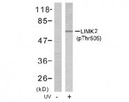 AP02415PU-S - LIMK2