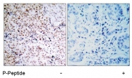 AP02418PU-S - Retinoblastoma-associated protein / RB1