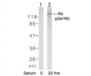 AP02418PU-S - Retinoblastoma-associated protein / RB1